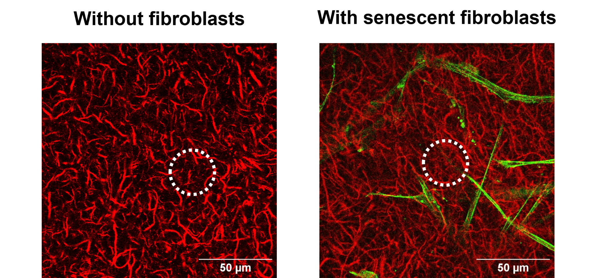 Macromolecular transport in collagen